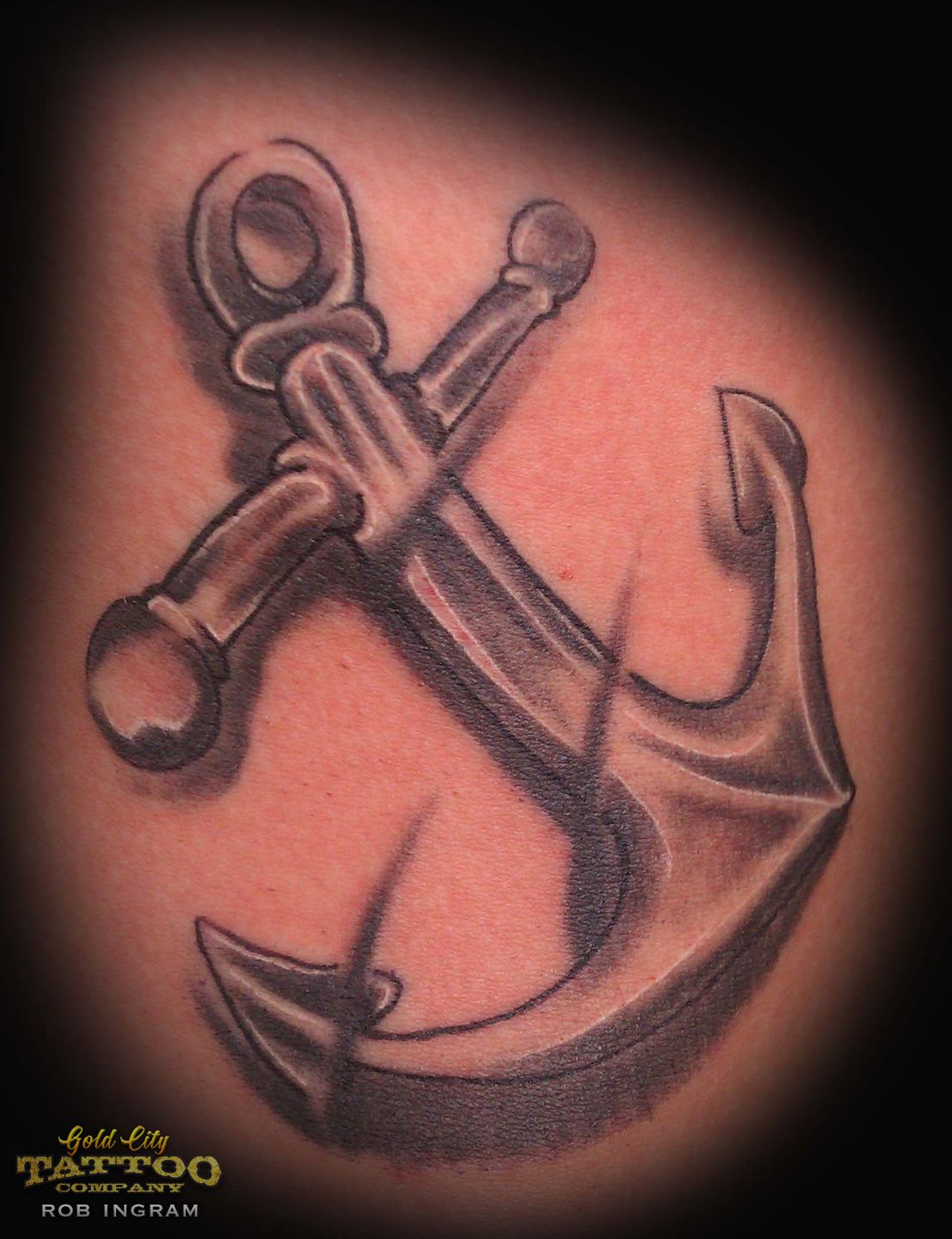 Anchor