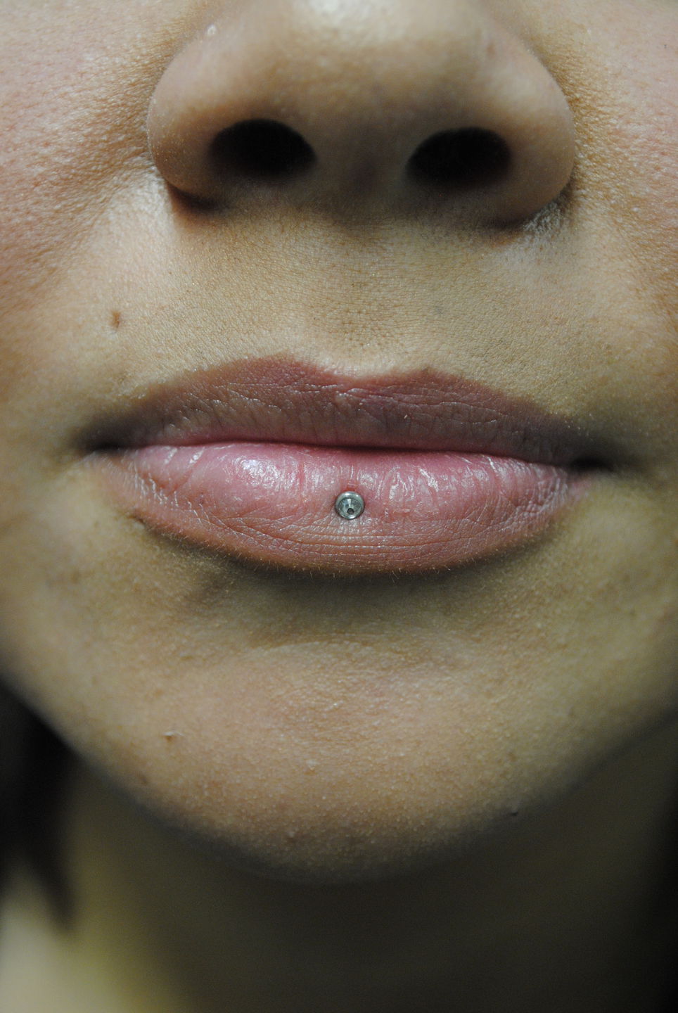 Inverted_vertical_labret