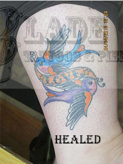 Cancdice_healed_leg