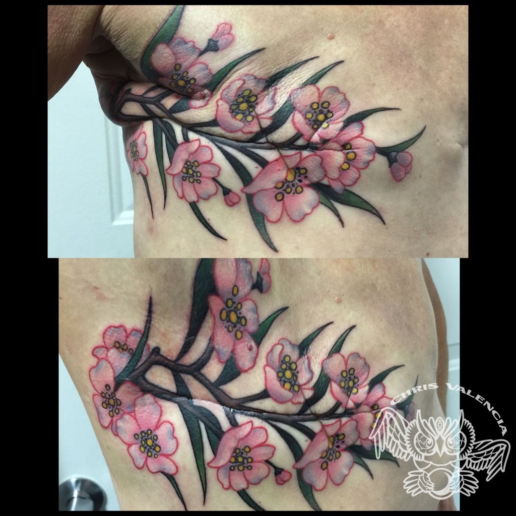 Lumpectomy Tattoos