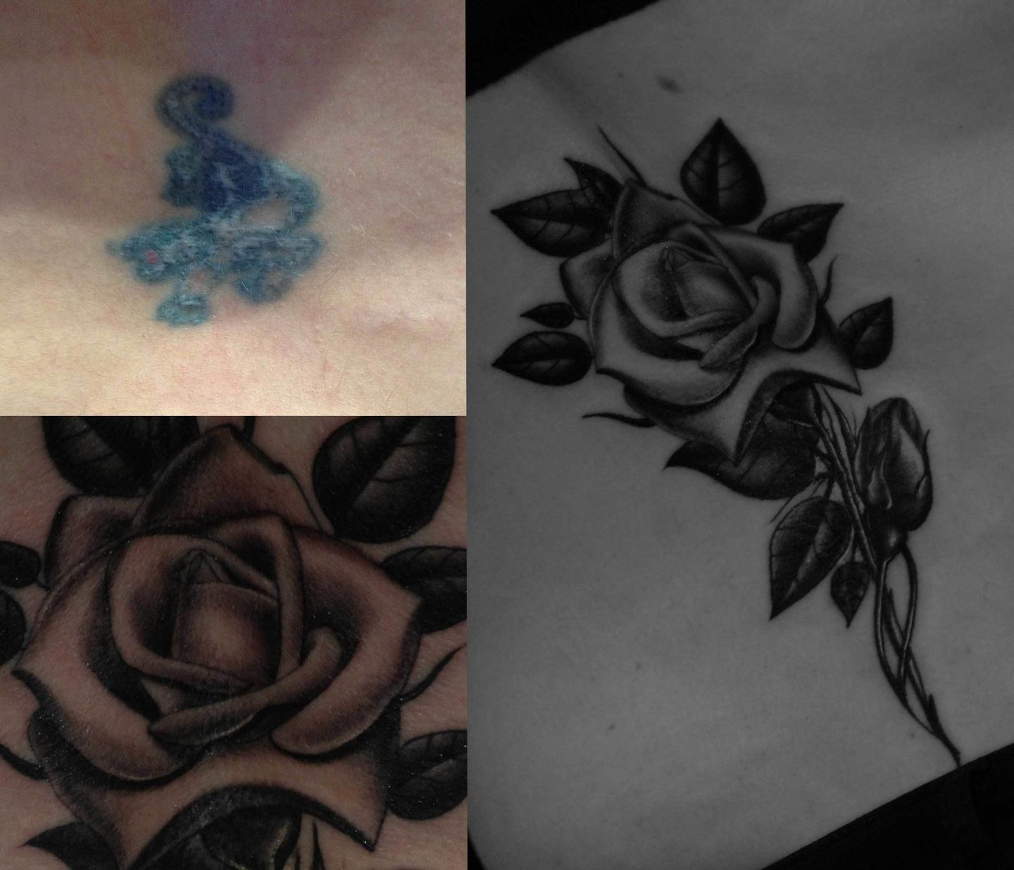 Rose-cover-up-rosemary-mckevitt-tattoo-ireland