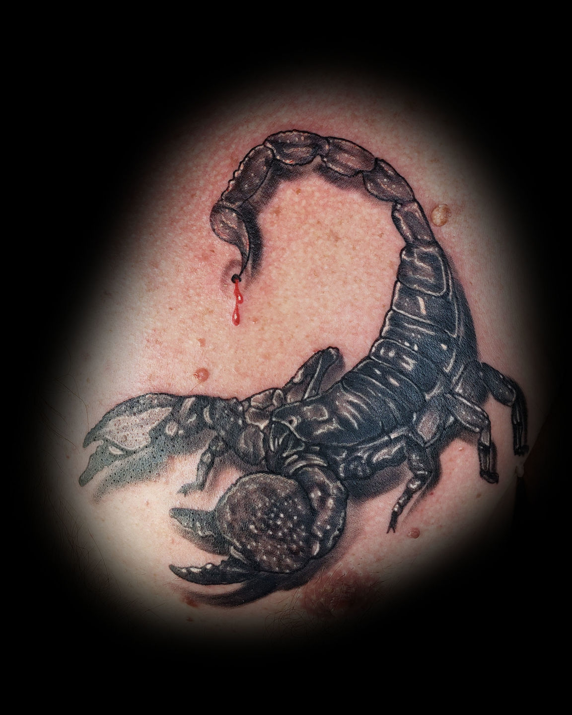 Scorpion